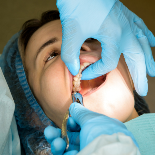 root canal treatment in gurgaon