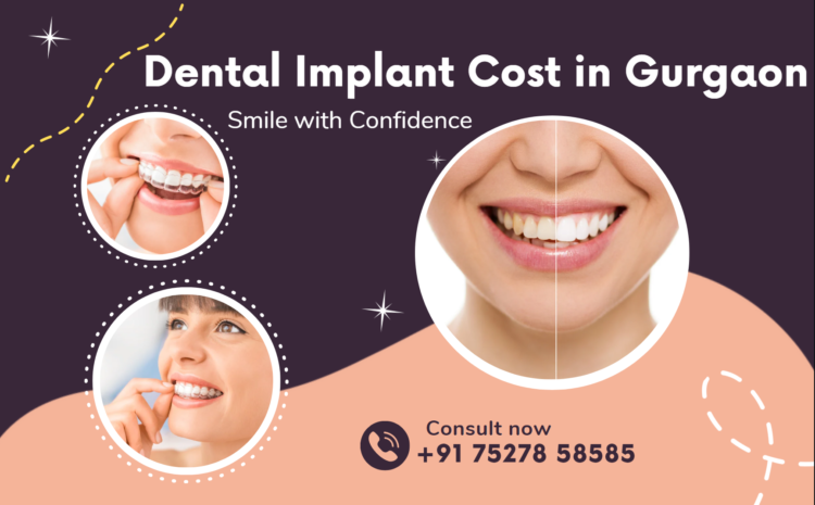  Dental Implant Cost in Gurgaon